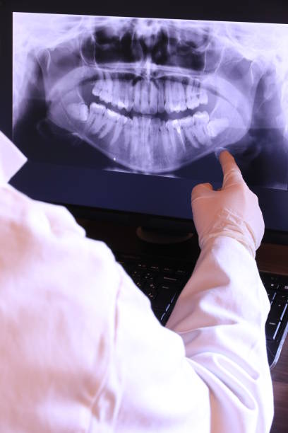 Best Knocked-Out Tooth (Avulsed Tooth) Treatment in Pine Island, TX