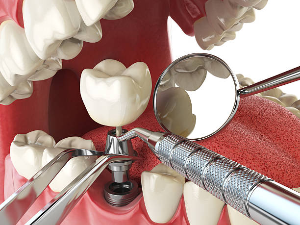 Best Emergency Treatment for Oral Infections in Pine Island, TX