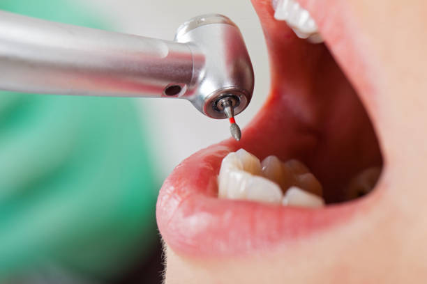 Best Urgent Dental Care for Toothaches in Pine Island, TX